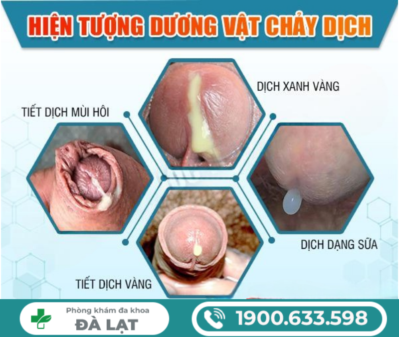 Hình ảnh minh họa